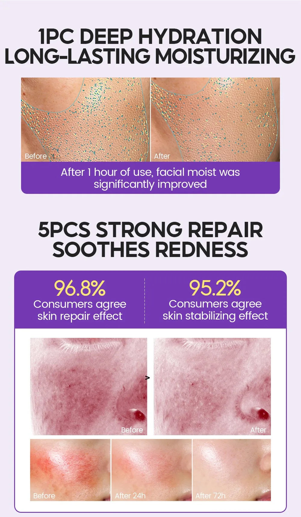 Retino Pro-xylane Ampoule serum Repairs Strengthens The Skin And Diminishes Fine Lines Face Beauty Skin Care 15pcs