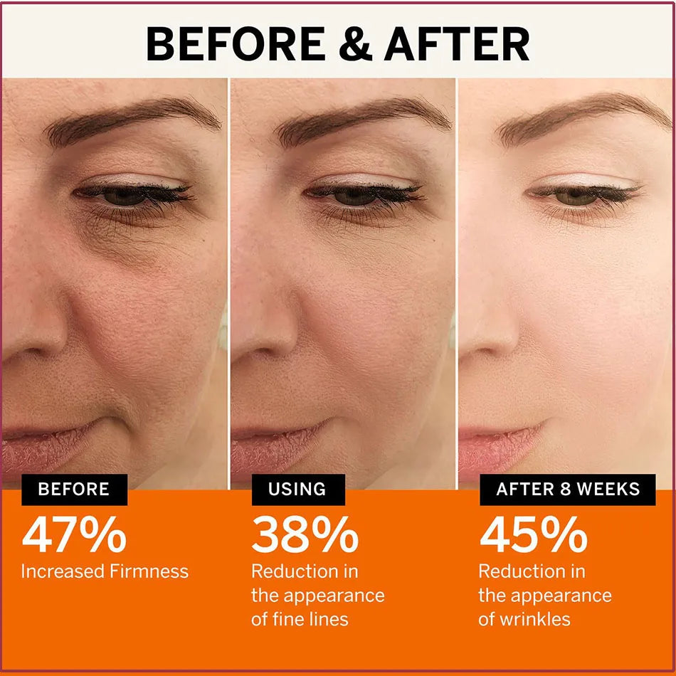 Retinol Body Lotion Firming For Face, Body, Dry Skin Improves Elasticity Age Rewind Serum For Face Serum Brightening