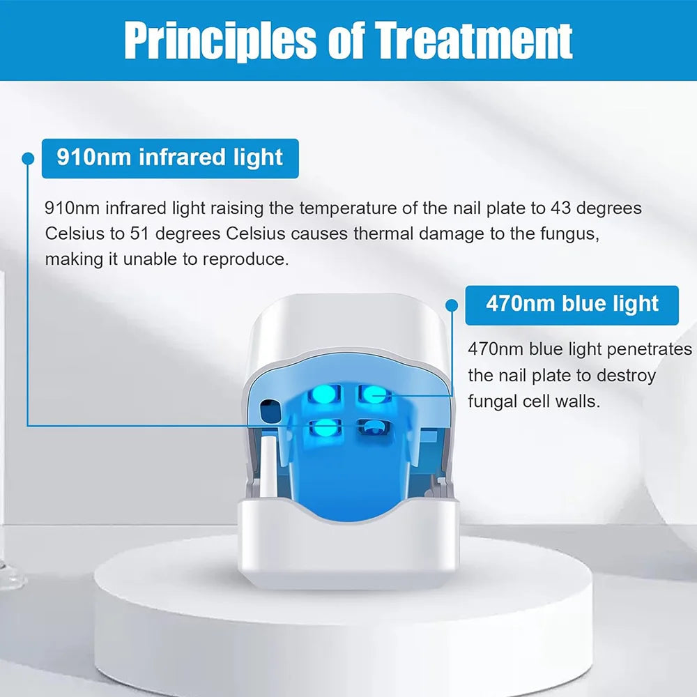 Nail Fungus Treatment LED Laser Device for Cleaning Onychomycosis USB Charge 905nm Infrared Light 470nm Blue Light Nail Salon