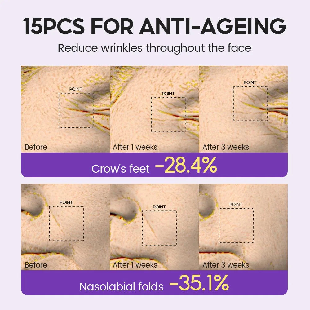 Retino Pro-xylane Ampoule serum Repairs Strengthens The Skin And Diminishes Fine Lines Face Beauty Skin Care 15pcs