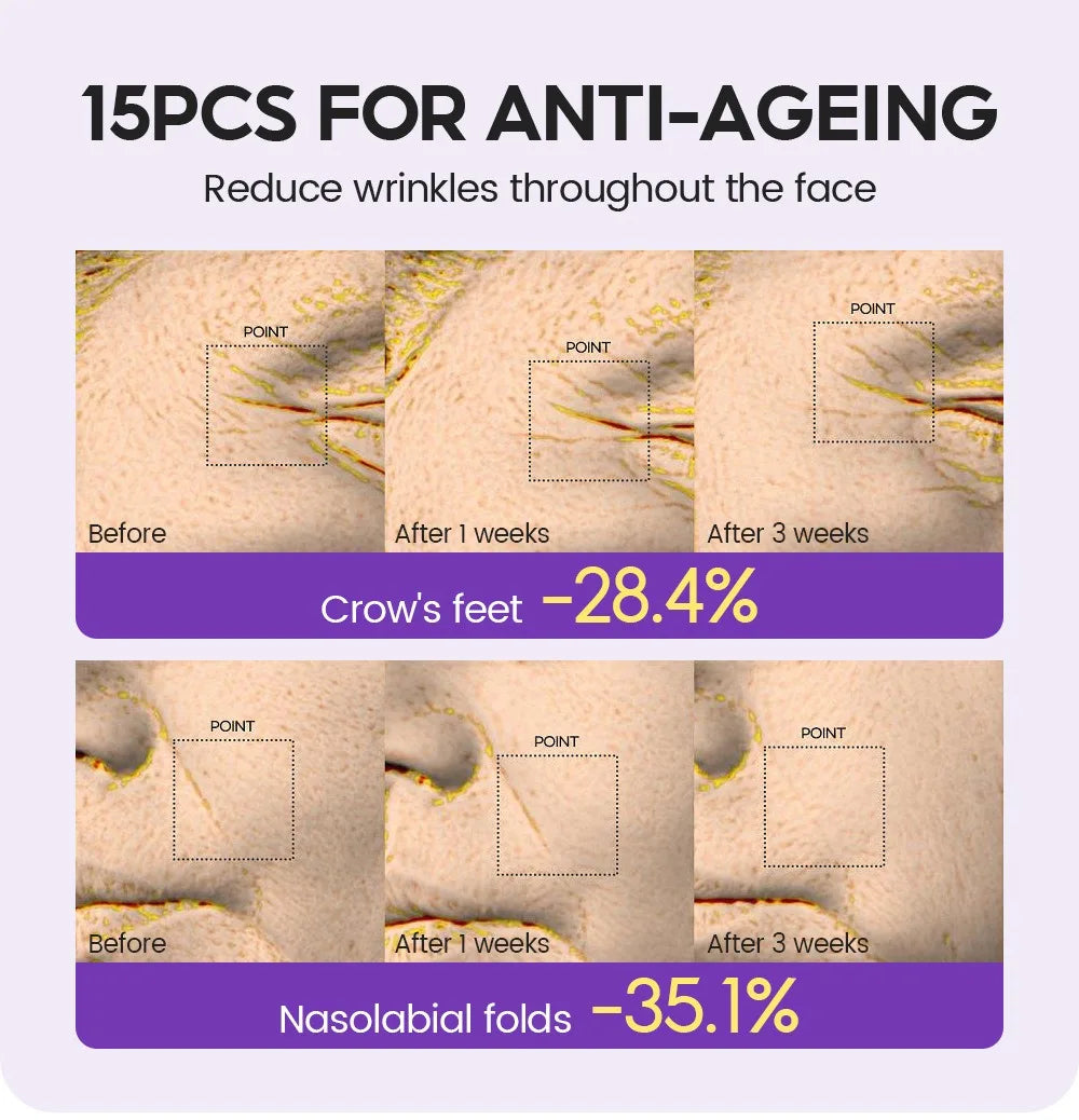 Retino Pro-xylane Ampoule serum Repairs Strengthens The Skin And Diminishes Fine Lines Face Beauty Skin Care 15pcs