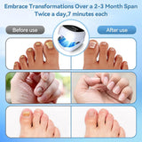 Nail Fungus Treatment LED Laser Device for Cleaning Onychomycosis USB Charge 905nm Infrared Light 470nm Blue Light Nail Salon