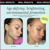 Retinol Body Lotion Firming For Face, Body, Dry Skin Improves Elasticity Age Rewind Serum For Face Serum Brightening