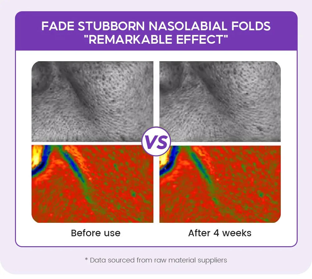 Retino Pro-xylane Ampoule serum  Repairs Strengthens The Skin And Diminishes Fine Lines Face Beauty Skin Care 15pcs