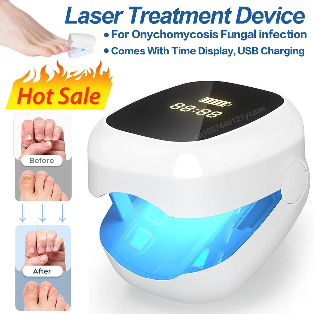 Nail Fungus Treatment LED Laser Device for Cleaning Onychomycosis USB Charge 905nm Infrared Light 470nm Blue Light Nail Salon