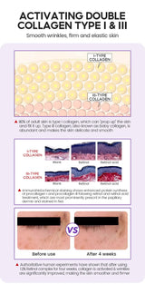 Retino Pro-xylane Ampoule serum  Repairs Strengthens The Skin And Diminishes Fine Lines Face Beauty Skin Care 15pcs