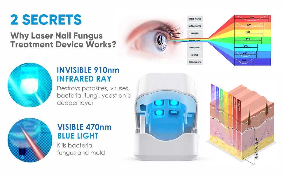 Nail Fungus Treatment LED Laser Device for Cleaning Onychomycosis USB Charge 905nm Infrared Light 470nm Blue Light Nail Salon
