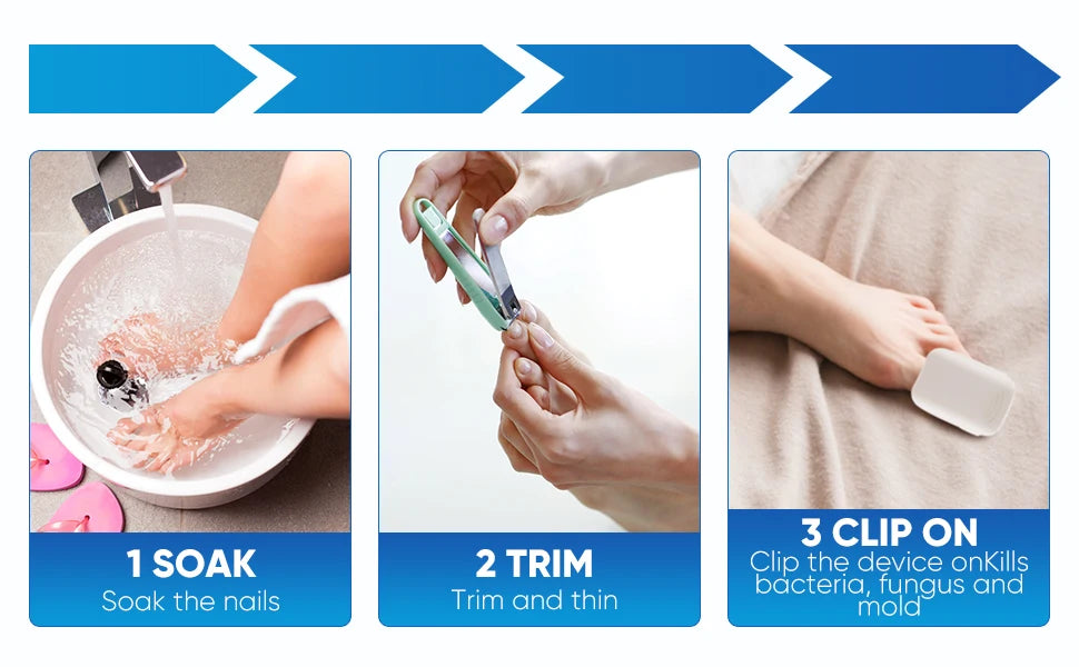 Nail Fungus Treatment LED Laser Device for Cleaning Onychomycosis USB Charge 905nm Infrared Light 470nm Blue Light Nail Salon